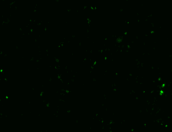 Inducible Tet-on vector transfection image