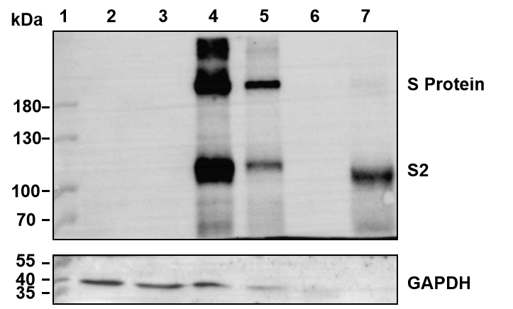Western blot analysis for 293T cells transfected with S pseudotyping lentivirus packaging plasmids.