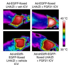 Partial view-Neutrophil elastase selectively kills cancer cells and attenuates tumorigenesis