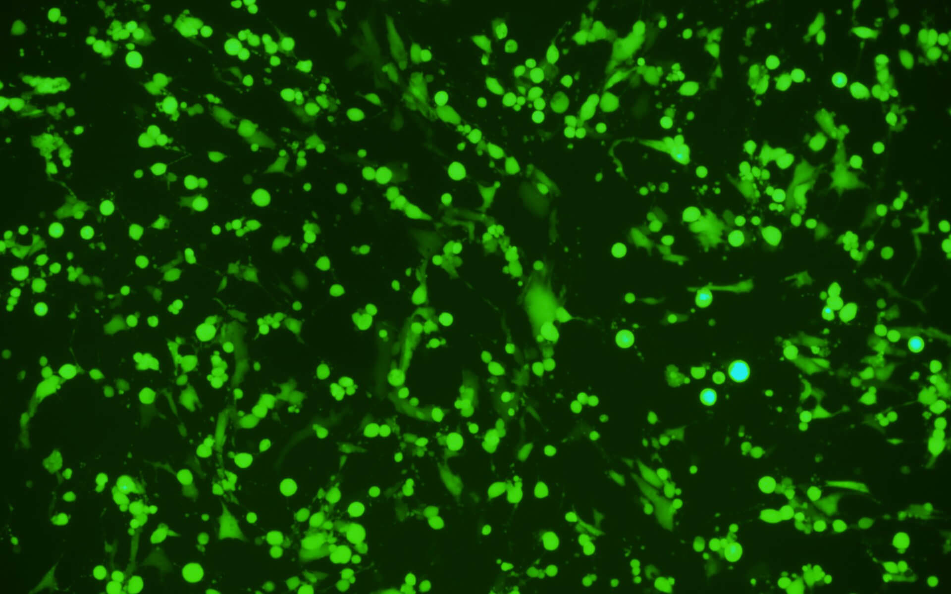 Fluorescent image: BHK-21 cells being transduced with VSV Psedotyped with S protein D614G mutant, and expresses EGFP.
