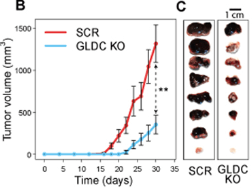 Glycine decarboxylase maintains mitochondrial protein lipoylation to support tumor growth