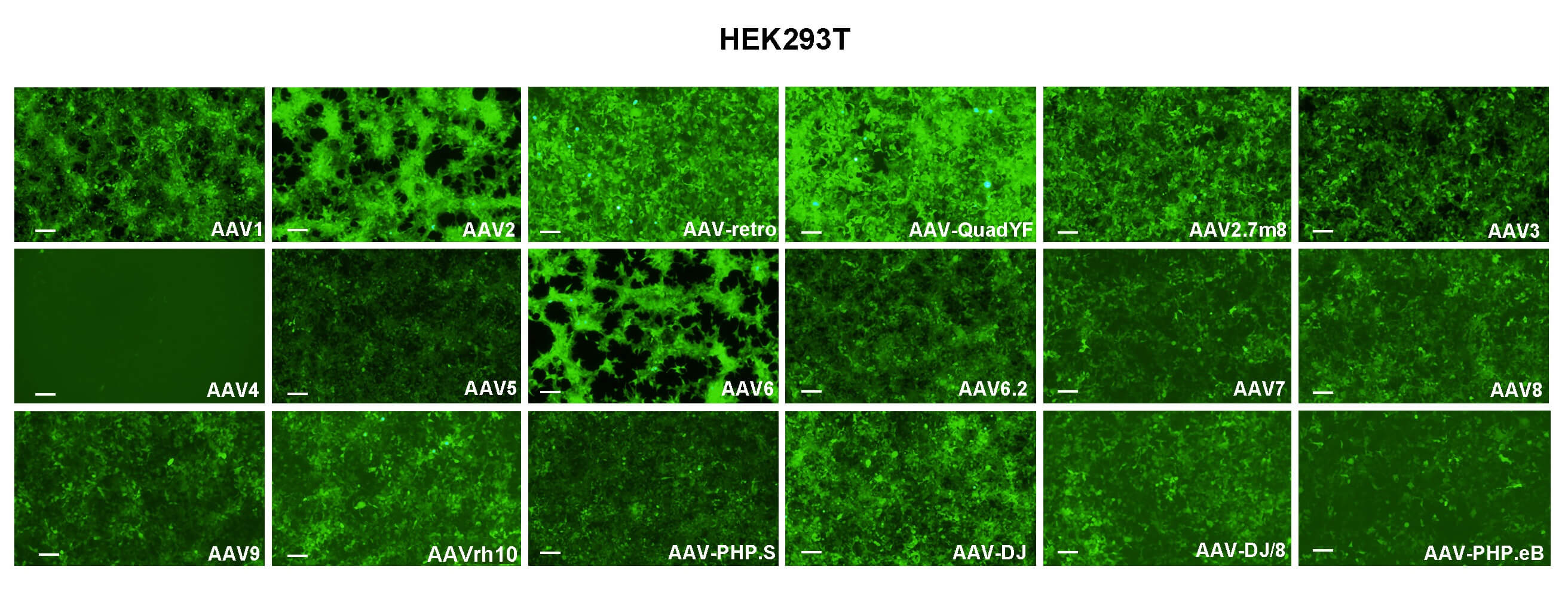 HEK293T cells were transduced with 18 serotypes of recombinant AAVs and presented strong EGFP fluorescent signals.