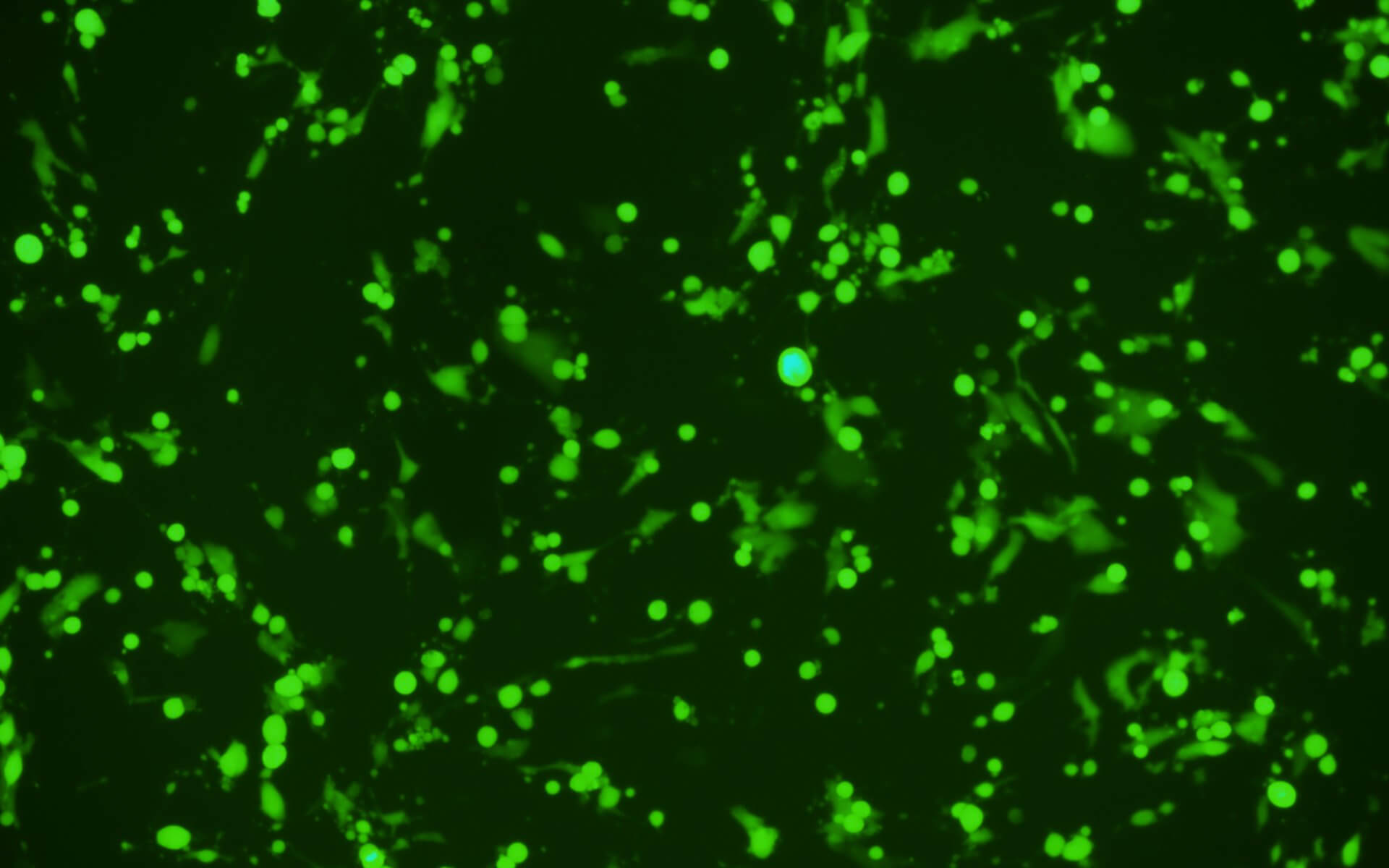 Fluorescent image: BHK-21-ACE2 cells being transduced with VSV Psedotyped with SARS-CoV-2 S protein, and expresses EGFP.