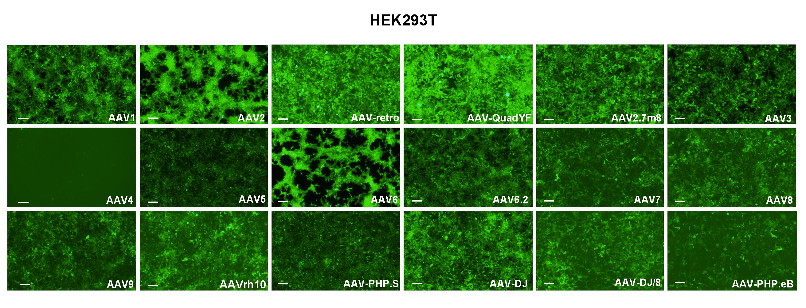 HEK293T cells were transduced with 18 serotypes of recombinant AAVs and presented strong EGFP fluorescent signal.